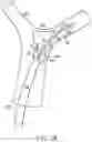 Fig. 08 - Single insertion delivery system for treating embolism and associated systems and methods
