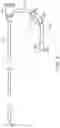 Fig. 13 - Single insertion delivery system for treating embolism and associated systems and methods