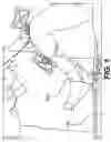 Fig. 02 - SYSTEMS AND METHODS FOR LEG STABILIZATION DURING KNEE ARTHROPLASTY SURGERY