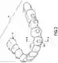 Fig. 04 - MAGNETIC ORTHODONTIC DEVICE