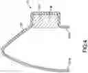Fig. 05 - MAGNETIC ORTHODONTIC DEVICE