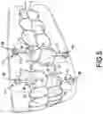 Fig. 06 - MAGNETIC ORTHODONTIC DEVICE