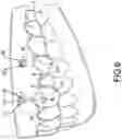 Fig. 07 - MAGNETIC ORTHODONTIC DEVICE