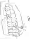 Fig. 08 - MAGNETIC ORTHODONTIC DEVICE