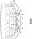 Fig. 09 - MAGNETIC ORTHODONTIC DEVICE