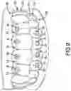 Fig. 10 - MAGNETIC ORTHODONTIC DEVICE