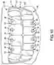 Fig. 11 - MAGNETIC ORTHODONTIC DEVICE