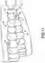 Fig. 12 - MAGNETIC ORTHODONTIC DEVICE