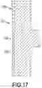 Fig. 18 - MAGNETIC ORTHODONTIC DEVICE