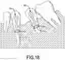 Fig. 19 - MAGNETIC ORTHODONTIC DEVICE