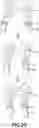 Fig. 21 - MAGNETIC ORTHODONTIC DEVICE