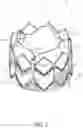 Fig. 02 - HEART VALVE MANUFACTURING DEVICES AND METHODS