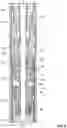 Fig. 07 - High speed electric submersible pumps