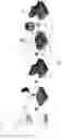 Fig. 03 - A METHOD FOR IMPRINTING MICROPATTERNS ON A SUBSTRATE OF A CHALCOGENIDE GLASS