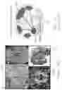 Fig. 02 - System and Method for Modeling Negatively Correlated Brain Epilepsy Network