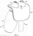 Fig. 03 - NASOPHARYNGEAL SAMPLE COLLECTION DEVICES AND METHODS