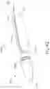 Fig. 68 - Surgical stapler with anvil seating detection