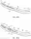 Fig. 45 - DEVICES AND METHODS FOR INCREASING BLOOD PERFUSION TO A DISTAL EXTREMITY