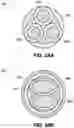 Fig. 06 - OPTICAL ASSEMBLIES TO IMPROVE ENERGY COUPLING TO PRESSURE WAVE GENERATOR OF AN INTRAVASCULAR LITHOTRIPSY DEVICE
