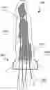 Fig. 01 - SYSTEM AND METHOD FOR AN ARTIFICIAL TENDON-DRIVEN PROSTHESIS