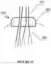 Fig. 04 - SYSTEM AND METHOD FOR AN ARTIFICIAL TENDON-DRIVEN PROSTHESIS