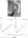 Fig. 11 - SYSTEM AND METHOD FOR AN ARTIFICIAL TENDON-DRIVEN PROSTHESIS