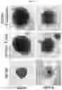 Fig. 45 - METHODS FOR PREDICTING RESPONSIVENESS OF CANCER TO FERROPTOSIS-INDUCING THERAPIES