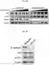 Fig. 49 - METHODS FOR PREDICTING RESPONSIVENESS OF CANCER TO FERROPTOSIS-INDUCING THERAPIES