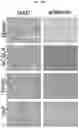 Fig. 85 - METHODS FOR PREDICTING RESPONSIVENESS OF CANCER TO FERROPTOSIS-INDUCING THERAPIES