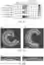 Fig. 89 - AAV DELIVERY OF NUCLEOBASE EDITORS