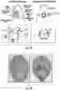 Fig. 02 - COMPOSITIONS AND METHODS FOR TREATING CEREBRAL VASOSPASM