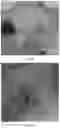 Fig. 06 - NANOVESICLES