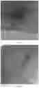 Fig. 07 - NANOVESICLES