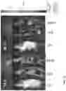 Fig. 15 - Drug delivery methods and compositions