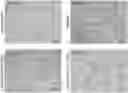 Fig. 01 - COMPOSITIONS AND METHODS FOR TREATMENT OF A FIBROTIC DISEASE