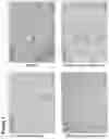 Fig. 02 - COMPOSITIONS AND METHODS FOR TREATMENT OF A FIBROTIC DISEASE