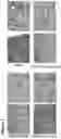 Fig. 03 - COMPOSITIONS AND METHODS FOR TREATMENT OF A FIBROTIC DISEASE