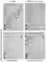 Fig. 08 - COMPOSITIONS AND METHODS FOR TREATMENT OF A FIBROTIC DISEASE