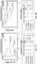 Fig. 19 - Methods of treating gastrointestinal stromal tumors