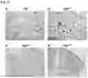 Fig. 11 - METHODS AND COMPOSITIONS FOR TREATING OBESITY AND/OR DIABETES AND FOR IDENTIFYING CANDIDATE TREATMENT AGENTS
