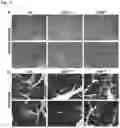 Fig. 12 - METHODS AND COMPOSITIONS FOR TREATING OBESITY AND/OR DIABETES AND FOR IDENTIFYING CANDIDATE TREATMENT AGENTS