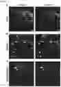 Fig. 15 - METHODS AND COMPOSITIONS FOR TREATING OBESITY AND/OR DIABETES AND FOR IDENTIFYING CANDIDATE TREATMENT AGENTS