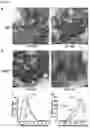 Fig. 17 - METHODS AND COMPOSITIONS FOR TREATING OBESITY AND/OR DIABETES AND FOR IDENTIFYING CANDIDATE TREATMENT AGENTS