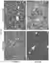 Fig. 36 - METHODS AND COMPOSITIONS FOR TREATING OBESITY AND/OR DIABETES AND FOR IDENTIFYING CANDIDATE TREATMENT AGENTS