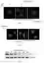 Fig. 04 - Methods of preventing or treating flavivirus virus infections and methods of inhibiting the entry of flvivirus, enterovirus or lentivirus into host cells