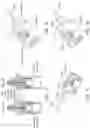 Fig. 06 - Infusion system and components thereof