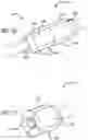 Fig. 09 - Methods And Devices For Establishing A Connection Between Adjacent Anatomical Spaces Using Magnets