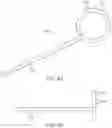 Fig. 07 - Helical balloon catheter