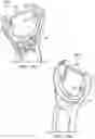 Fig. 32 - Razor handle with movable members