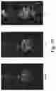 Fig. 28 - PSMA-targeting compounds and uses thereof